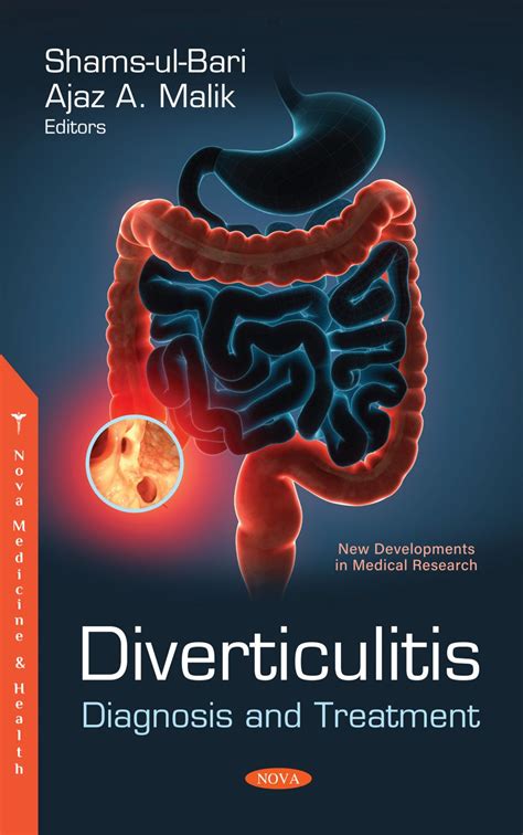 Diverticulitis: Diagnosis and Treatment – Nova Science Publishers