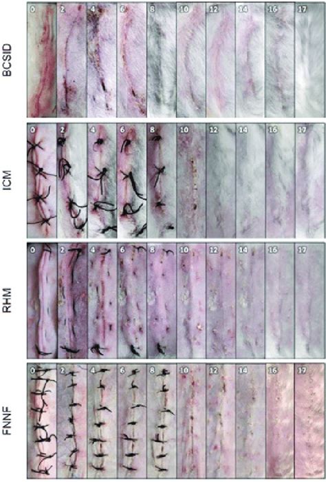 representative plates showing the gross changes of successful wound ...