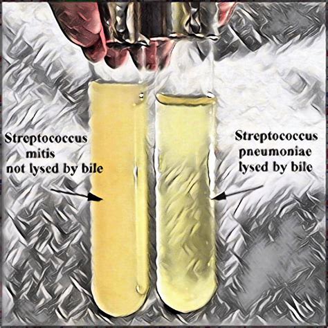 Bile Solubility Test