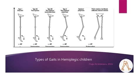 Management of Gait in Hemiplegic CP