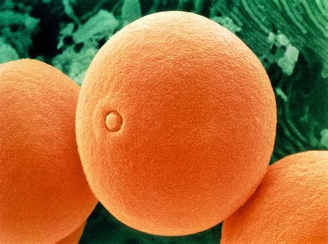 Pollen Grains Under Microscope | Amusing Planet