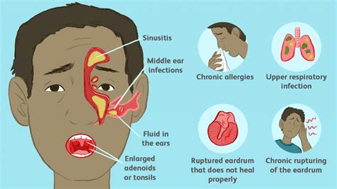 How to Sleep with an Ear Infection - 10 Tips and Tricks - 33rd Square