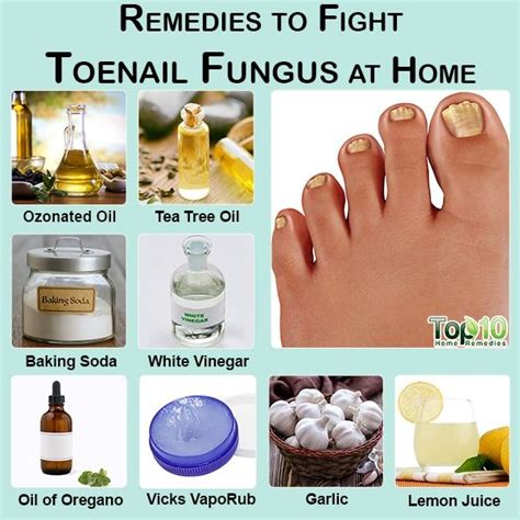 10 Remedies to Fight Toenail Fungus at Home | Top 10 Home Remedies ...