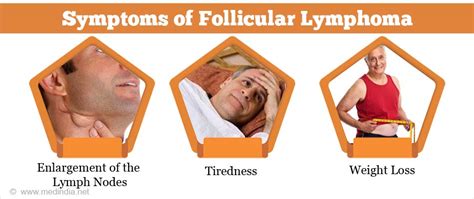 Follicular Lymphoma - Causes, Symptoms, Diagnosis, Treatment and Prevention