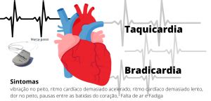 Arritmia cardíaca: o que é, sintomas e tratamento