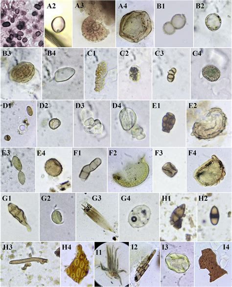 Fungal Spores Under Microscope