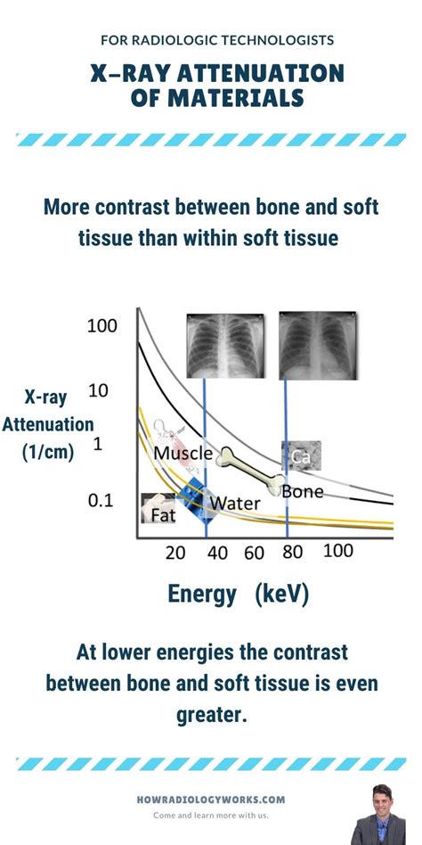 Attenuation Of X Ray Beam - The Best Picture Of Beam