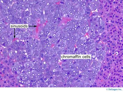 Peripheral Nervous System Histology - Adrenal medulla (labels ...