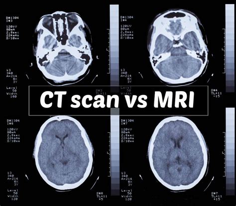 CT vs. MRI: Understanding the Differences - Kings Medical Group