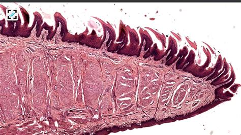 Histology of tongue filiform and fungiform papillae - YouTube