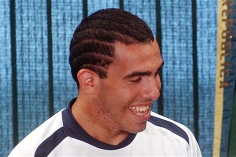 How Did Franck Ribéry And Carlos Tevez Get Their Permanent Scars? - I'm ...