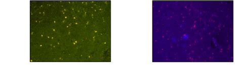 Examples of immunohistochemistry. | Download Scientific Diagram