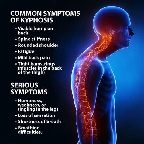 Kyphosis Symptoms, Treatment | Florida Orthopaedic Institute