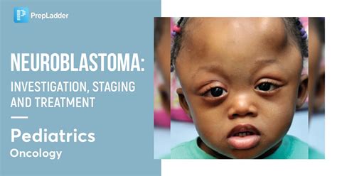 Neuroblastoma -Investigation, Staging and Treatment