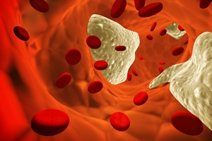 Mia¿d¿yca - cholesterol [© frenta - Fotolia.com]