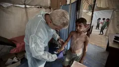 طفل فلسطيني يتلقى العلاج من مرض جلدي في قطاع غزة